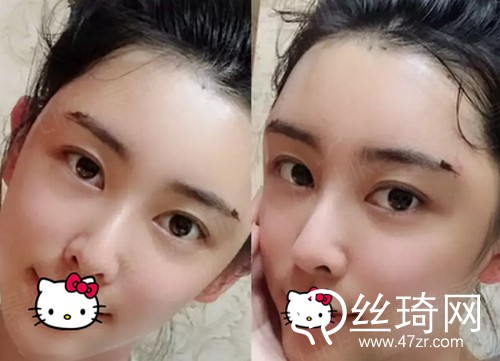 四川美萊醫(yī)學(xué)美容醫(yī)院熊猛怎么樣