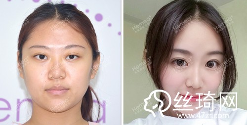 北京禾美嘉醫(yī)療美容怎么樣內(nèi)附2019全新價(jià)格表