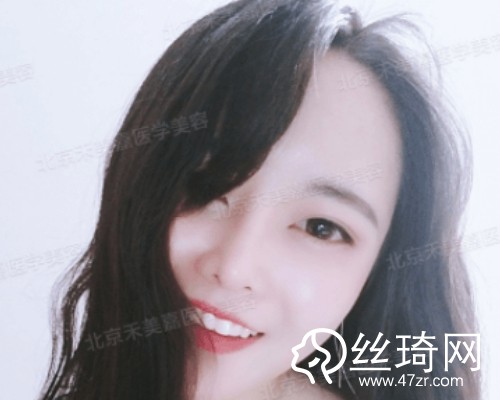 北京禾美嘉醫(yī)療美容自體脂肪填充面部那個(gè)醫(yī)生好？