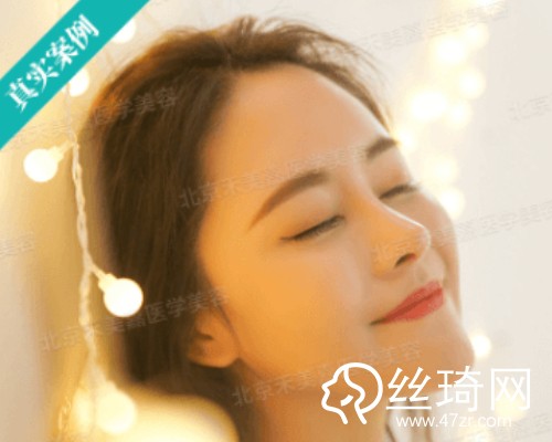 北京禾美嘉醫(yī)療美容自體脂肪填充面部那個(gè)醫(yī)生好？