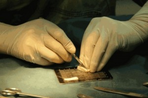 玻尿酸隆鼻也有被嫌棄的時(shí)候，你該怎么選?