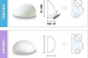 隆胸假體那么多，我們應(yīng)該如何選擇呢?