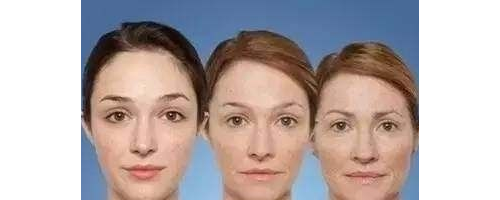 面部年輕化，多方面進入時代