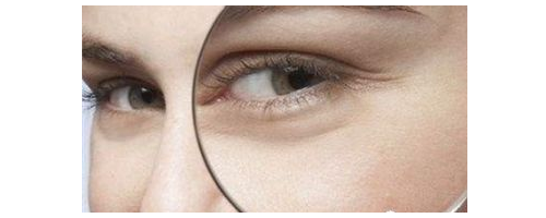 去魚尾紋要多少錢，去魚尾紋價(jià)格貴不貴