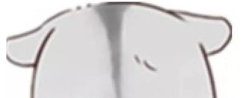 顴骨寬大，選擇顴弓內(nèi)推還是脂肪填充？哪個能讓臉變小