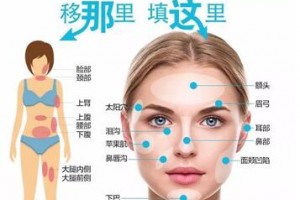 自體脂肪填充，將脂肪變廢為寶！自體脂肪的成活率高嗎