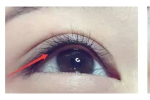 做美瞳線，疼不疼？半永.久美瞳線優(yōu)勢(shì)有哪些