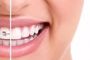 30歲后做牙齒矯正來得及嗎？做正畸會有什么危害？