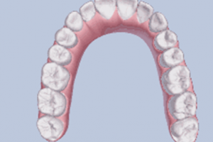 牙齒矯正，要多久? 我32歲可以做矯正嗎？