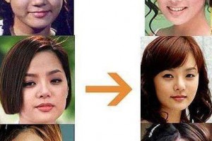 南寧美麗焦點(diǎn)整形醫(yī)院全新價(jià)格表