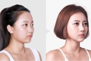 南京安安醫(yī)療整形美容醫(yī)院價(jià)格表