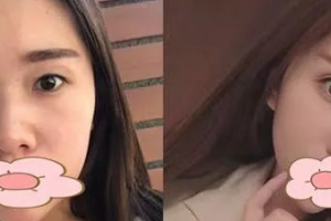 南寧邢文明整形醫(yī)院整形美容價(jià)格貴不貴