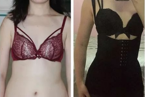 為什么吸脂減肥不容易反彈？只有肥胖者才能吸脂嗎？