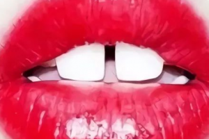 門牙縫大“漏財”還毀顏值，整形牙科醫(yī)教你2招關(guān)縫納財！