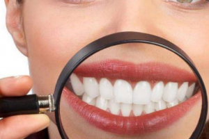 杭州美萊口腔醫(yī)院，口腔知識(shí)科普：牙齒美白多少錢一次？