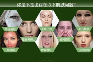 光子嫩膚果好不好 哪些人不適合光子嫩膚