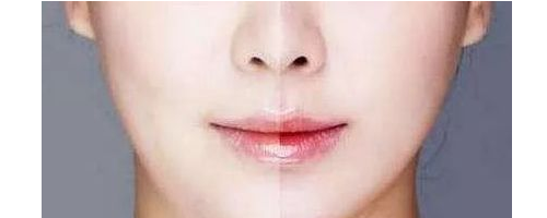 3分鐘，帶你了解醫(yī)美“黑話”