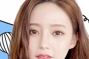 深圳割雙眼皮需要多少錢