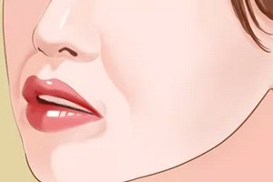 天生法令紋很深怎么辦？