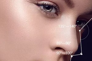 鼻中隔軟骨隆鼻有哪些優(yōu)勢(shì)呢