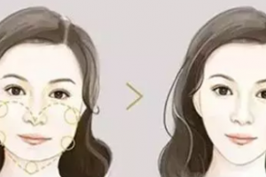 聽說許多明星都去打肉‘毒素’，有什么果？