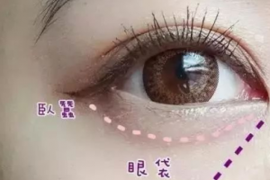 這3個(gè)溝不解決，永遠(yuǎn)顯老！