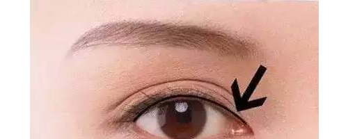 美瞳線這么美，你一定要做！