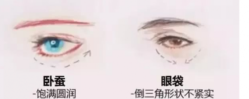 玻尿酸注射『臥蠶』，你需要嗎？