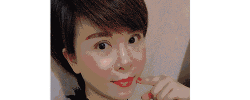 深圳藝星整形醫(yī)生常德成：她脂肪填充后，臉居然變小了？