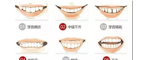 為什么牙齒矯正這么貴？