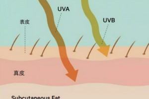 深圳藝星整形醫(yī)生王明海：為什么有些人夏天曬不黑？而你一曬就黑…