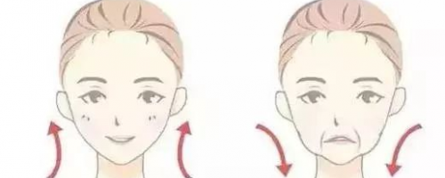 【法令紋】玻尿酸VS埋線提升，去法令紋到底哪個好？