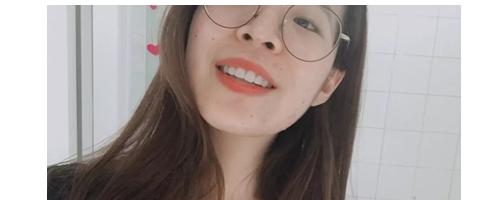 分享一些牙齒矯正的事情，希望能幫到你