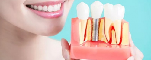 花了上萬塊的種植牙，怎么護(hù)理才能更耐用呢？