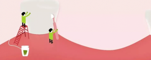 家人不用擔心我的胃口了！牙齒種植Soeasy！