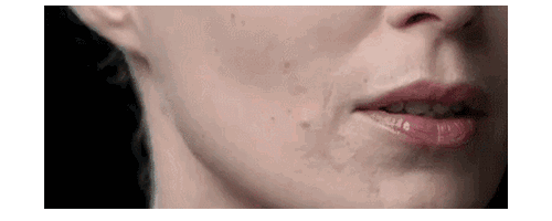 揭開埋線提升秘密，幫你留住仙氣！