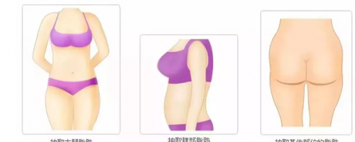 科普你真的了解自體脂肪填充么？