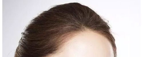 為什么祛斑越祛越多？