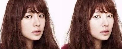 臥蠶與眼袋有什么區(qū)別？為什么臥蠶顯得可愛(ài)而眼袋會(huì)顯老呢