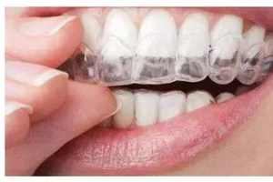 牙齒矯正后，臉會(huì)瘦嗎？臉型會(huì)產(chǎn)生哪些變化