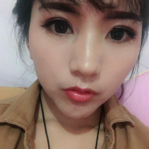 北京知音整形整形價格表一覽及醫(yī)院整形介紹