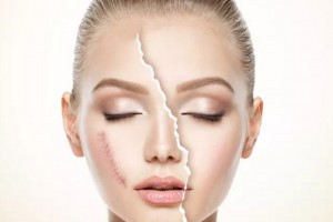 北京伊美爾整形醫(yī)院整形價格表一覽及醫(yī)院整形介紹