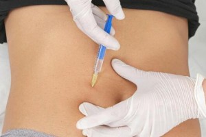 大連微美整形整形價格表及醫(yī)院介紹