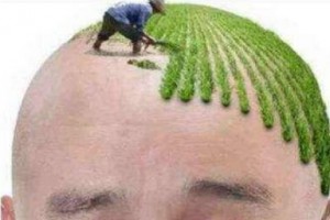 北京瑞麗詩(shī)植發(fā)怎么樣附全新價(jià)格表(價(jià)目表)