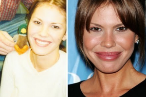 河南省現(xiàn)代醫(yī)學研究院中醫(yī)院毛發(fā)移植科室怎么樣附全新價格表(價目表)