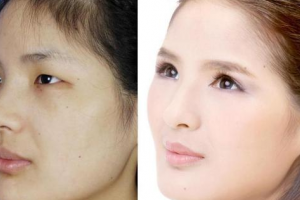 鄭州二七醫(yī)院植發(fā)中心怎么樣附全新價格表(價目表)