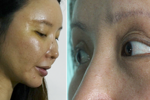 南京科發(fā)源植發(fā)怎么樣附全新價格表(價目表)