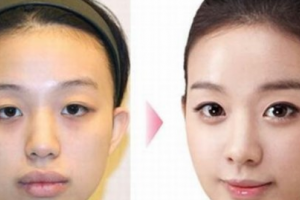 廣東博士園植發(fā)怎么樣附全新價格表(價目表)