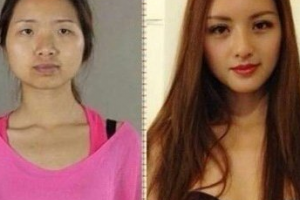 武漢美都久生生毛發(fā)移植怎么樣附全新價格表(價目表)