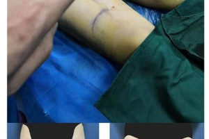 上海交通大學(xué)醫(yī)學(xué)院附屬第九人民醫(yī)院整形美容科整形價(jià)格表一覽及醫(yī)院介紹